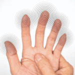 Latest Breakthroughs in Neuropathic Pain Treatments You Should Know